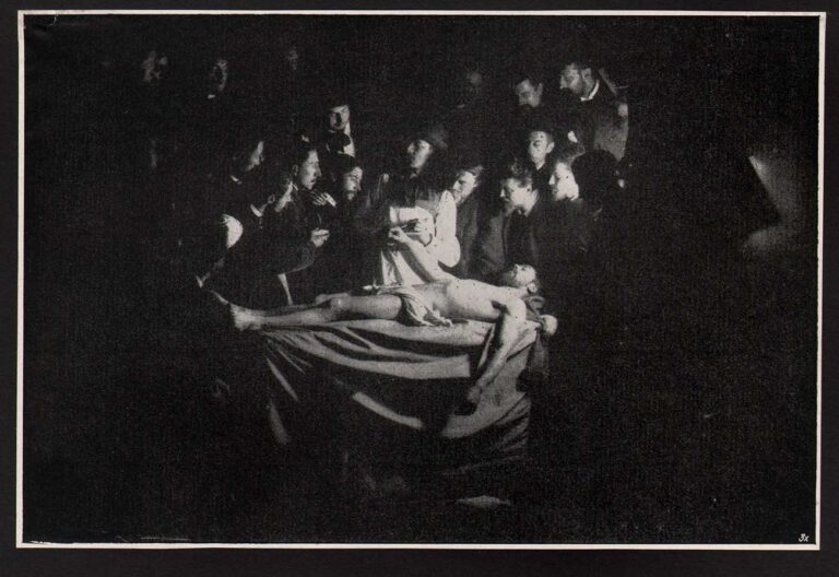 La Laçon D’Anatomie