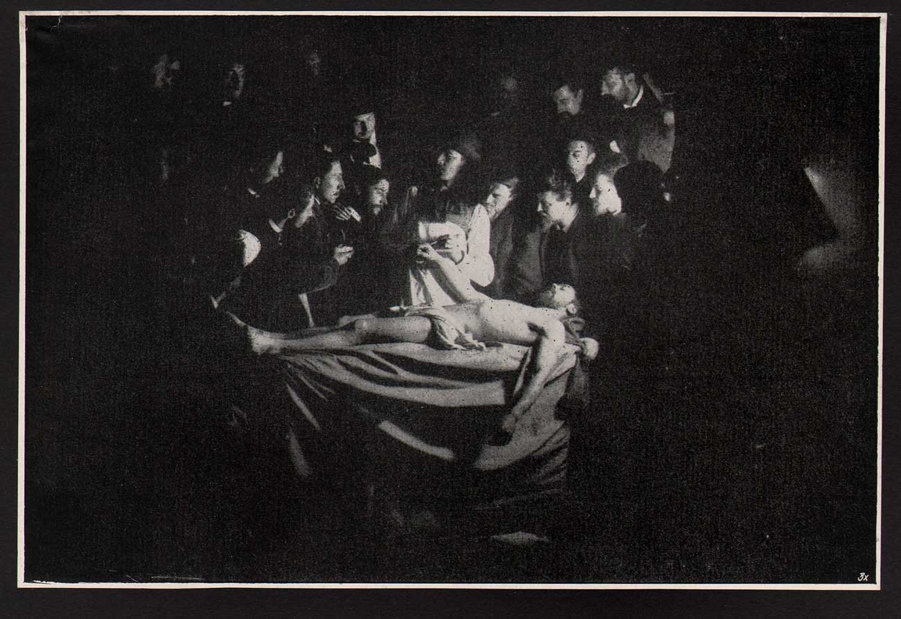 La Laçon D’Anatomie